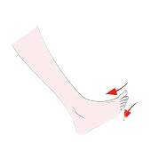 Atfl Injury of Ankle