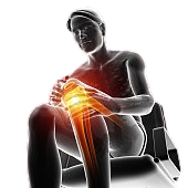 LCL Injury