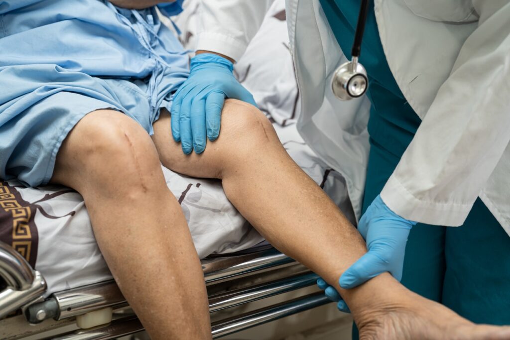 Minimally Invasive Knee Replacement