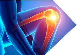 Best Joint Replacement Surgeon